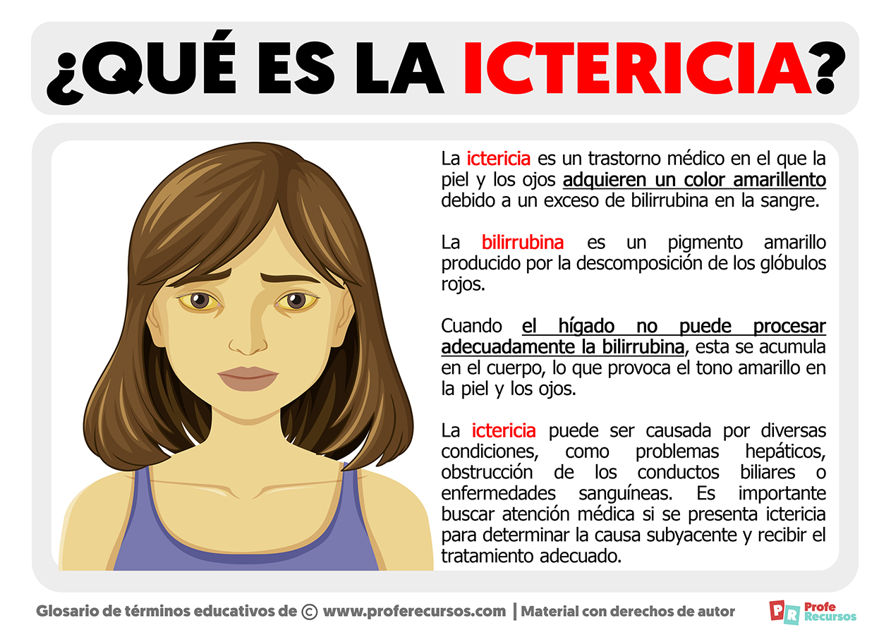 Que es la ictericia