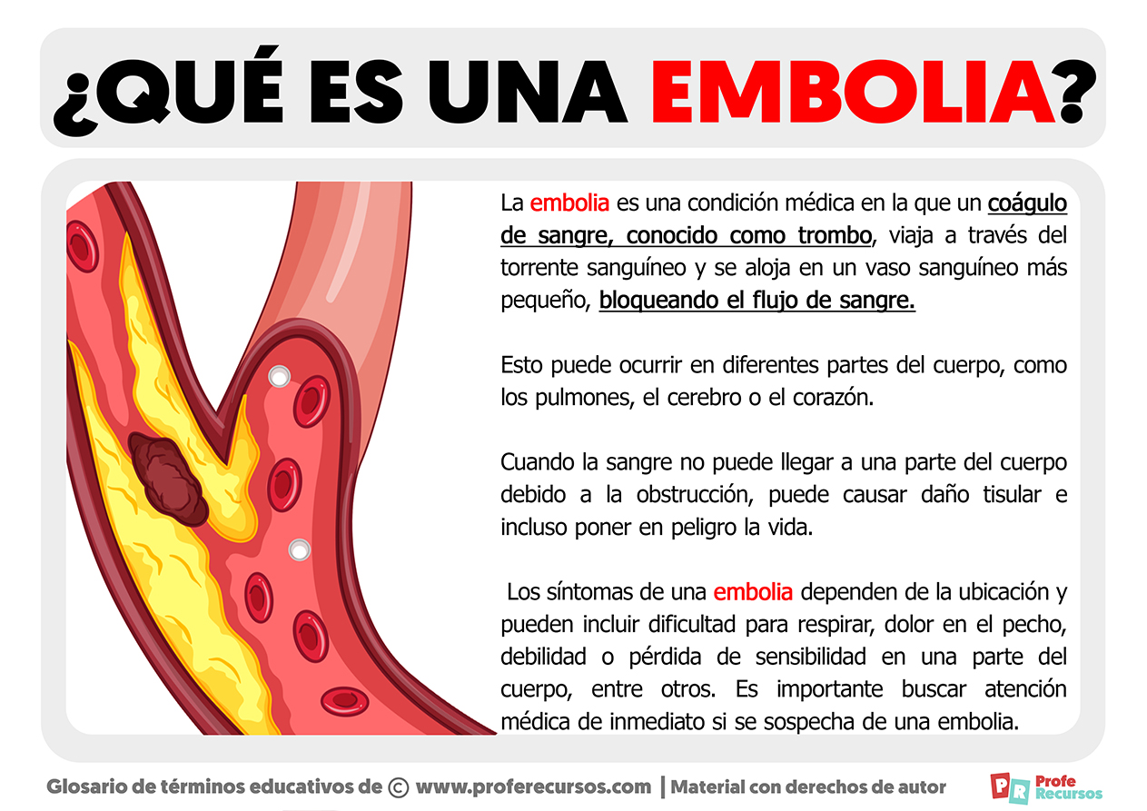 Que es la embolia