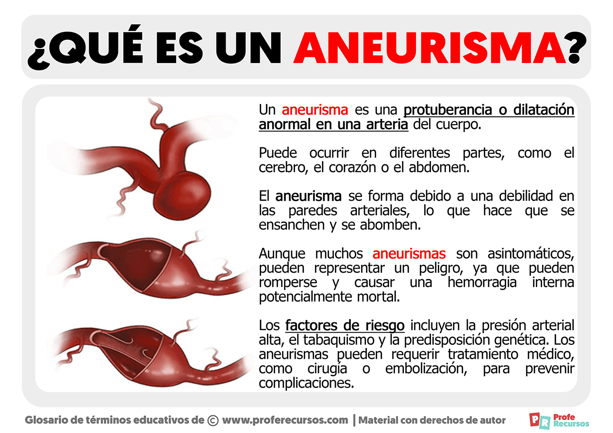 Que es un aneurisma