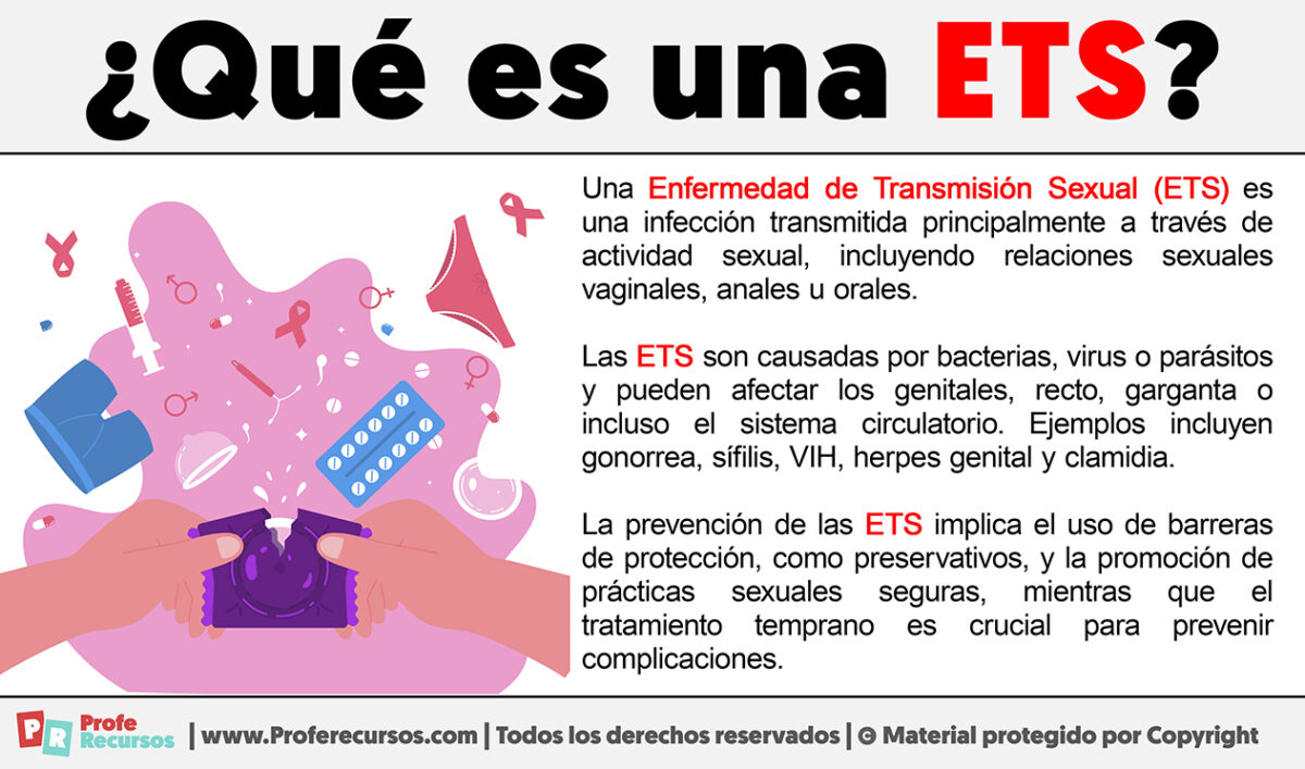 Qué es una ETS Definición de ETS