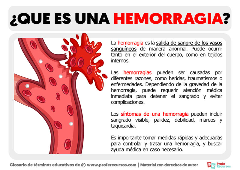 Qué es una Hemorragia | Definición de Hemorragia
